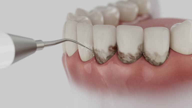 Trusted Teeth Cleaning And Checkup service in Gardendale, AL - Dentist Open Now